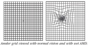 Amsler grid